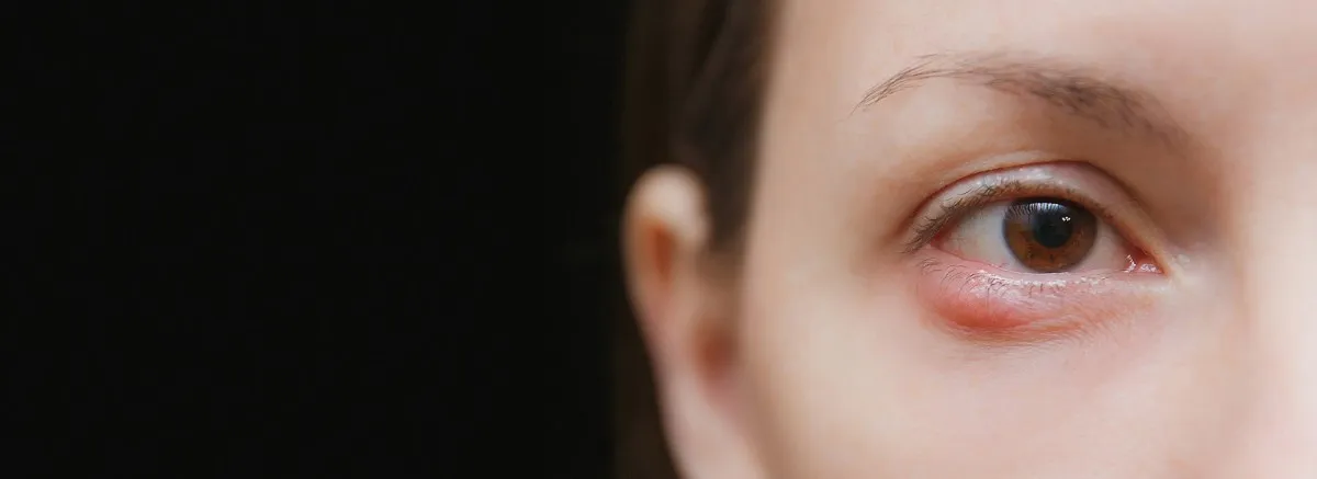 Χαλάζιο – Κριθαράκι